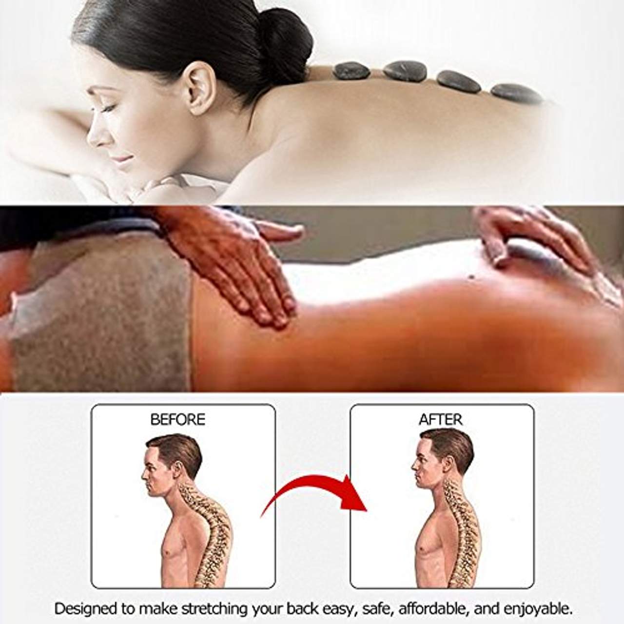 Lixada Rückendehner Rückenstretcher Traktionsmassagegerät