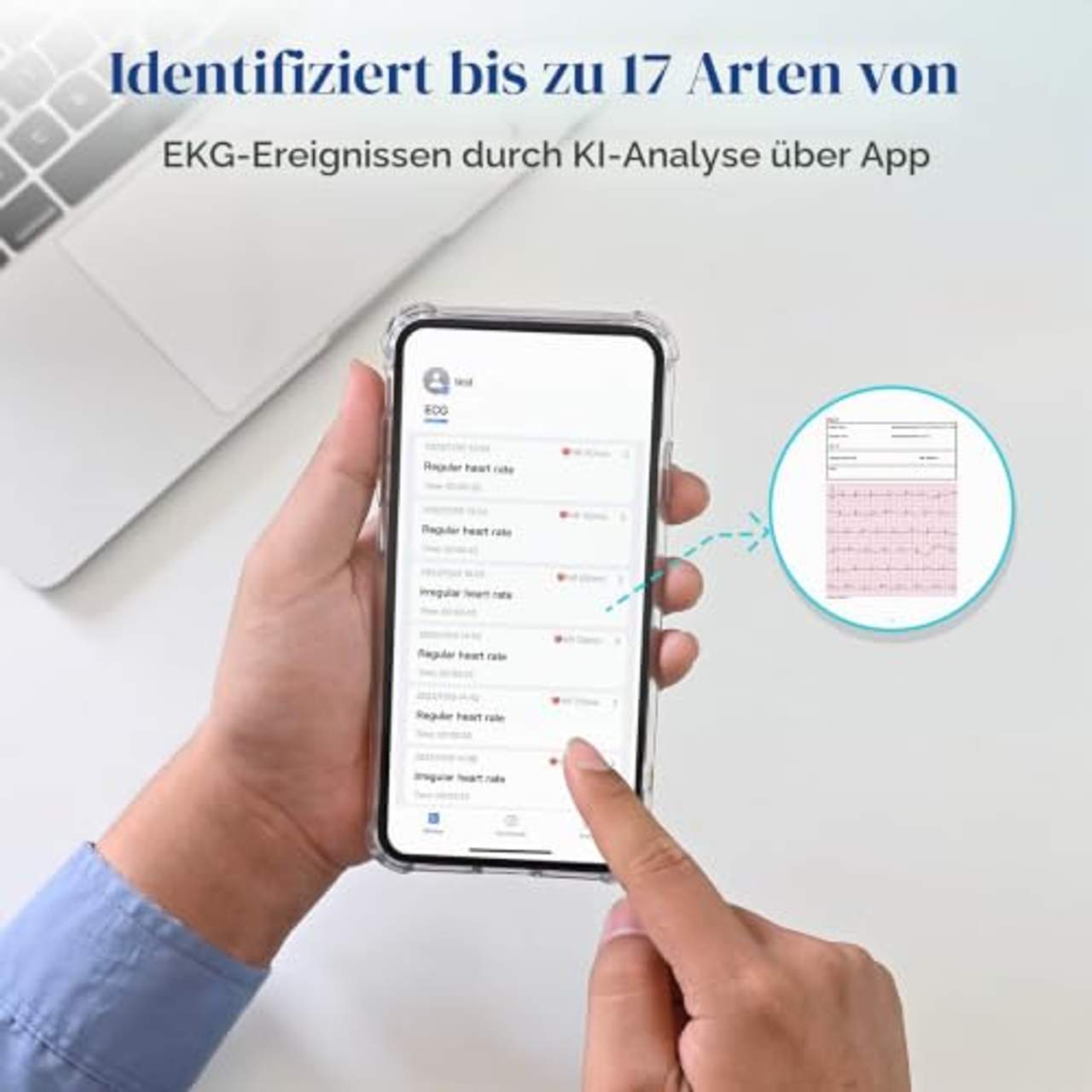 CheckMe ER2-S EKG für Zuhause